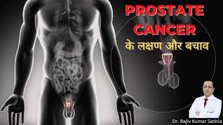A Chat About Prostate Cancer | Explained in 5 Minutes | Hindi | Dr. Rajiv Kumar Sethia
