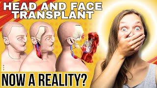 HEAD AND FACE TRANSPLANT: Now A Reality? #transplants #headtransplant #facetransplant #surgery #head