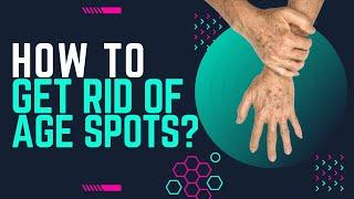 How To Get Rid of Age Spots?