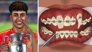 ASMR Help Lamine Yamal brace his ugly teeth | Dental care