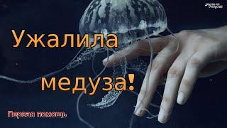 Что делать, если ужалила медуза?  Первая помощь. / What to do if a jellyfish stings? First aid.