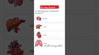 Which body part is affected by jaundice? #medicalstudent #nursing #bodyparts #viralshort