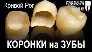 Коронка на зуб: сколько стоит поставить коронку (цена в г. Кривой Рог, Украина)
