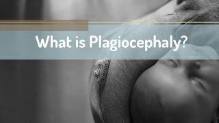 What is Plagiocephaly?