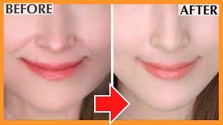 Get Rid of Smile Lines Naturally in 3 mins! | Laugh Lines, Nasolabial Folds, Sagging Around Mouth