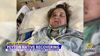 Southern Colorado woman recovering from brutal attack in Huntington Beach