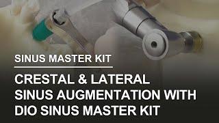 DIO Sinus Master Kit hands-on video