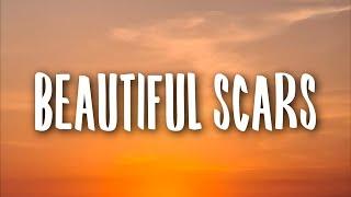 Maximillian - Beautiful Scars (Lyrics)