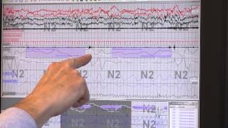 Reading Sleep Study Results: Identifying Sleep Apnea