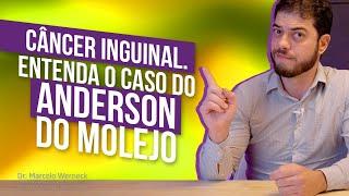 Câncer Inguinal. Entenda o Caso do Anderson do Molejo