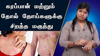 தோல் பிரச்சனை, எக்ஸிமா,கரப்பான் நோய்,அரிப்பு | Skin Problem,Eczema,Karappan,Itching | Dr.Yoga Vidhya