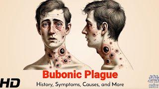 Bubonic Plague: The Black Death