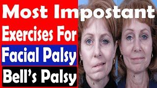 MOST IMPORTANT EXERCISES FOR FACIAL PALSY | BELL'S PALSY EXERCISES | FACIAL PARALYSIS EXERCISES