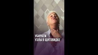 Как убрать узлы в щитовидка | Пономарева Галина Владимировна | #shorts