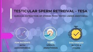 Surgical Sperm Retrieval for AZOOSPERMIA / NIL SPERM - TESA  (High Success Rate when used with ICSI)