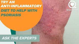 Try an Anti inflammatory Diet to Help with Psoriasis | Ask the Experts | Sharecare