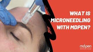 What is MicroNeedling with MDPen?