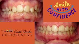 Welcome to Smile Studio Orthodontics