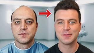 Haartransplantation in der Türkei