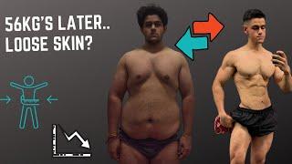 MY 56KG WEIGHT LOSS JOURNEY INTO BODYBUILDING! | LOOSE SKIN?! | SENSEI SWOLE