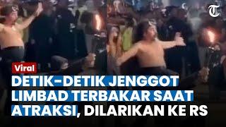 Atraksi Sembur Api, Jenggot Master Limbad Terbakar Hingga Harus Dioperasi