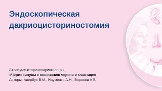 Эндоскопическая дакриоцисториностомия. Операцию проводит Алексей Владимирович Воронов.