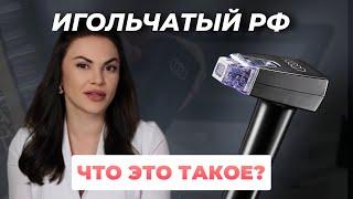 ИГОЛЬЧАТЫЙ РФ: Что это? Для чего нужен и как работает?