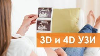 Для чего нужно 3D УЗИ при беременности? | Беременность и роды