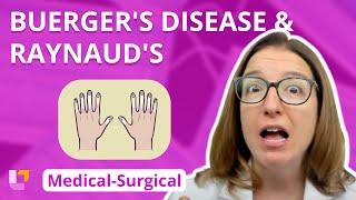 Buerger's Disease and Raynaud's - Medical-Surgical - Cardiovascular System |  @LevelUpRN