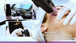 Unleashing the Power of MORPHEUS8 for a Youthful Transformation with Cocoona Clinic