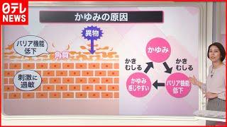 【解説】かゆみに“粉ふき”…ただの乾燥ではなく「皮脂欠乏症」  暖房との“距離”を意識『知りたいッ！』