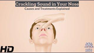 Crackling Noise in Your Nose? Discover the Triggers and Solution