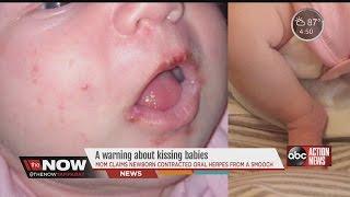 Mom issues a warning about kissing babies