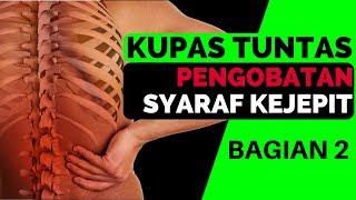 Best treatment to cure Sciatica PART 2