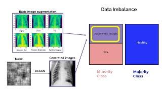 Image Augmentation for Imbalanced Medical Datasets