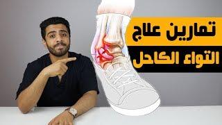 علاج التواء الكاحل وتورمه/والطريقه الصحيحه لربط الرباط الضاغط لحالات التواء الكاحل