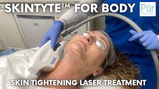 What is SkinTyte For Body? | Skin Tightening Laser Skin Treatment For Sagging Skin | Pūr Skin Clinic