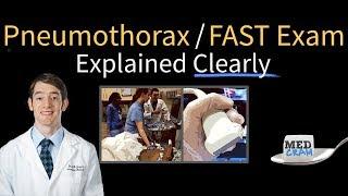 Pneumothorax on Ultrasound - FAST Exam Explained Clearly