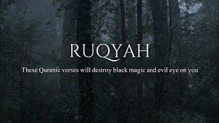 RUQYAH - Spiritual Treatment For Black Magic, Jinn & Evil Eye | Omar Hisham Al Arabi @qadrirecordss