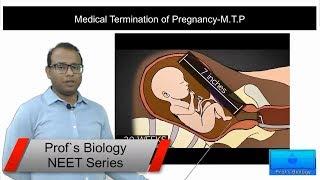 Medical Termination of Pregnancy-MTP