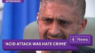 'Acid attack was a hate crime': London victim speaks out