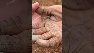 Get Rid Of Extremely Dry Cracked Hands| Hand Moisturizer For Soft & Supple Hands | #shorts #viral