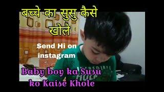 How To Open Baby Boy's Private Part | Bacche Ka Susu Ko Kaise Khole | बच्चे का सुसु को कैसे खोले