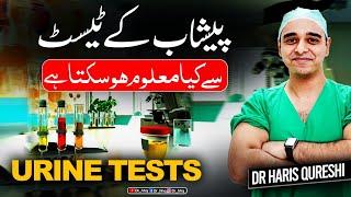 What can be known by Urine Tests? Urine DR cultureپیشاب کے ٹیسٹ سے کیا معلوم ہو سکتا ہے؟ Urdu Hindi