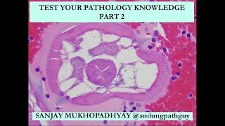 Test Your Pathology Knowledge, Part 2