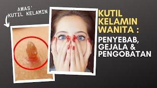 KUTIL KELAMIN PADA WANITA : PENYEBAB, GEJALA & PENGOBATAN