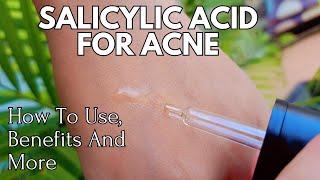 Salicylic Acid For Acne : How To Use, Benefits And More