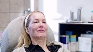 Ultherapy® München / Ultraschall-Lifting bei Dr. Tatjana Pavicic