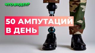 Как СВО изменила доступность протезов в РФ / как получить дорогостоящий протез за счет государства