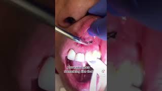 #new #tiktok #foryou #trending #dance #music #dentist #viral#video #fyp #instagram #youtubeshorts